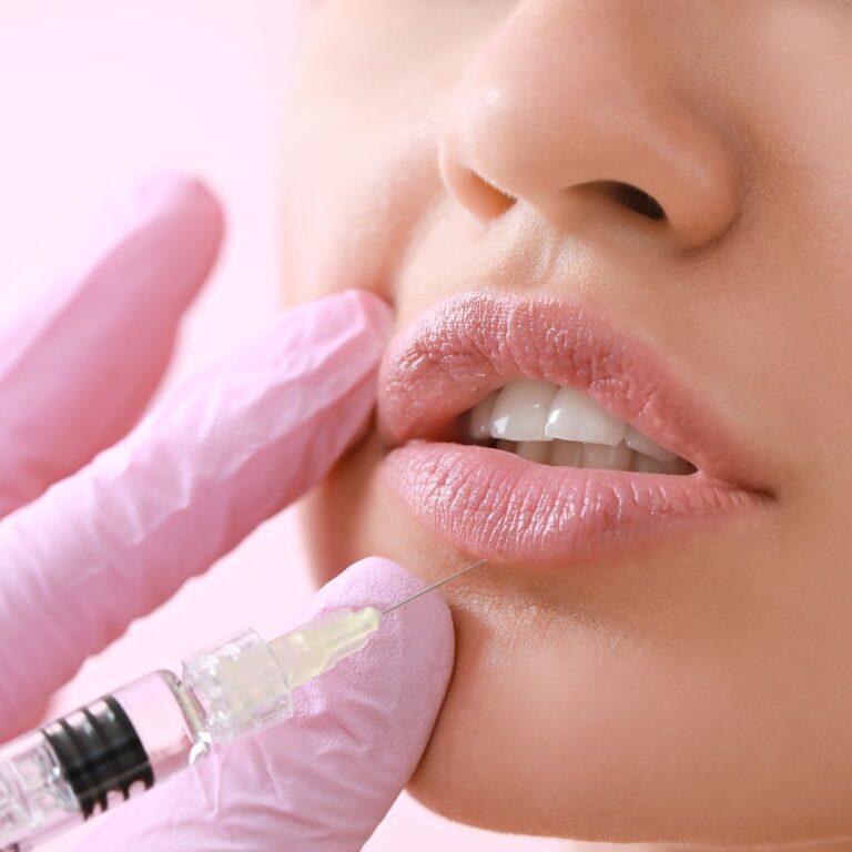 Read more about the article Lip Fillers: Pouting with Purpose or Just a Fad?